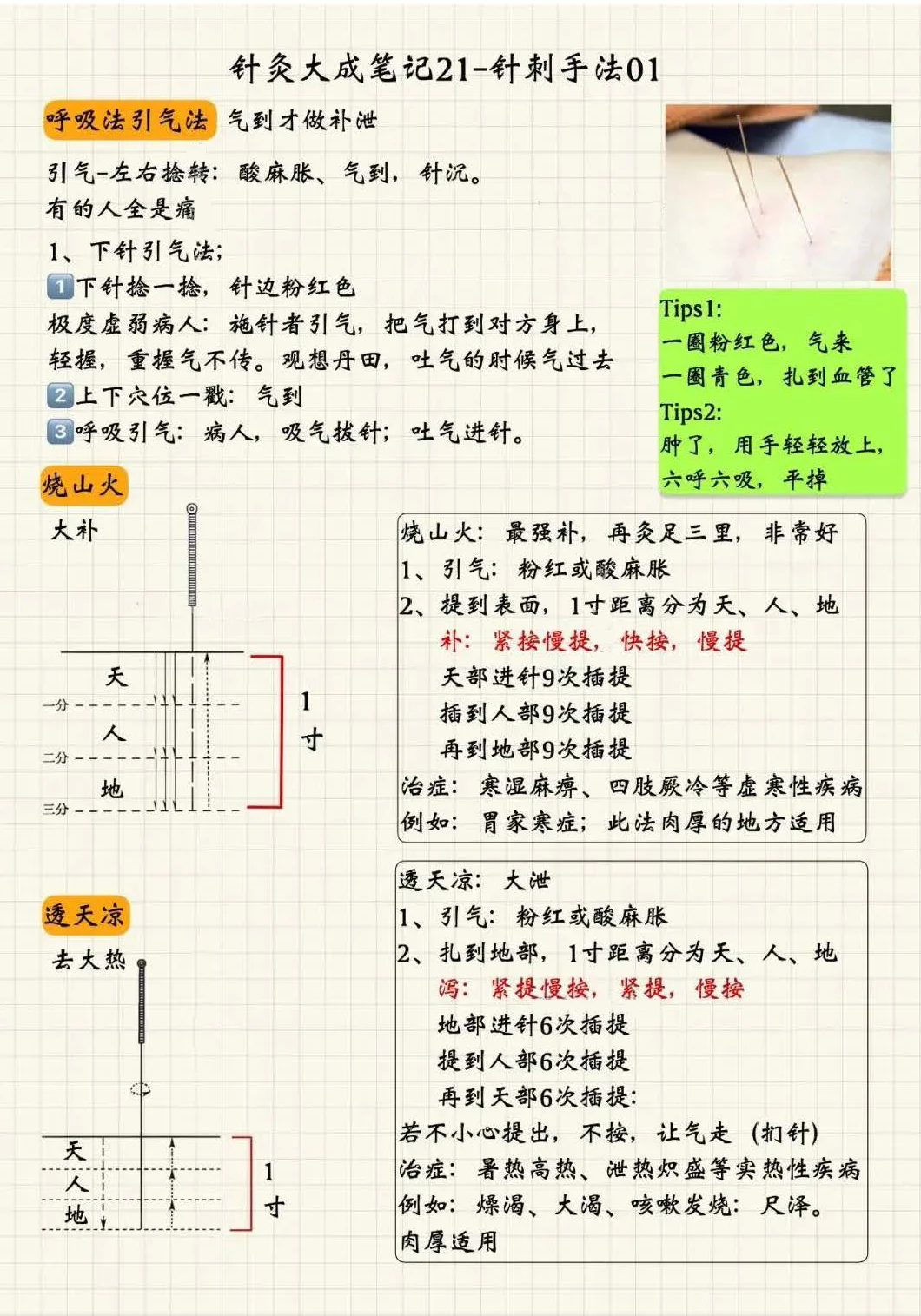针刺手法1